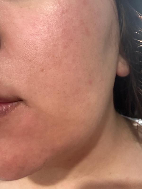 Review Thumbnail Image 4 289394894