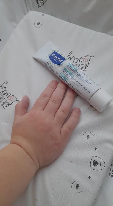 Mustela Stelatopia Intense Crème apaisante - Eczéma atopique des bébés