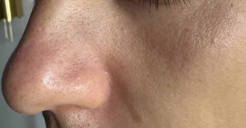 Pores look much smaller