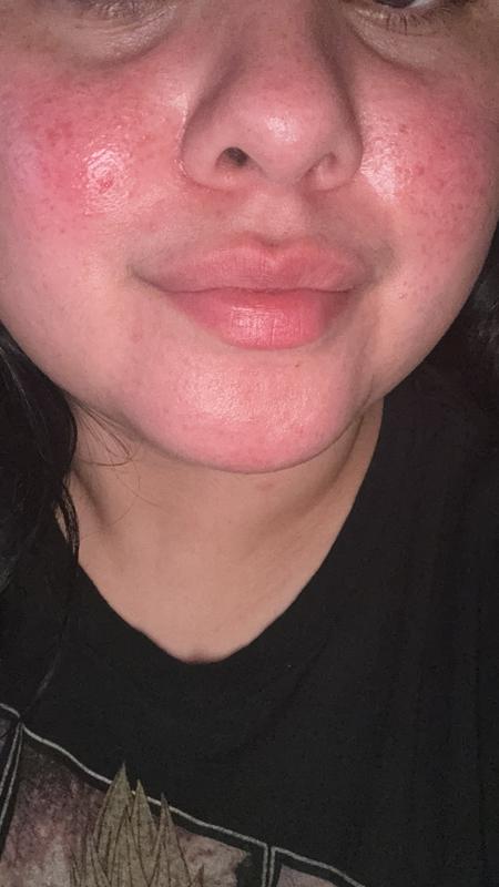 Sensitive skin safe (for me!)