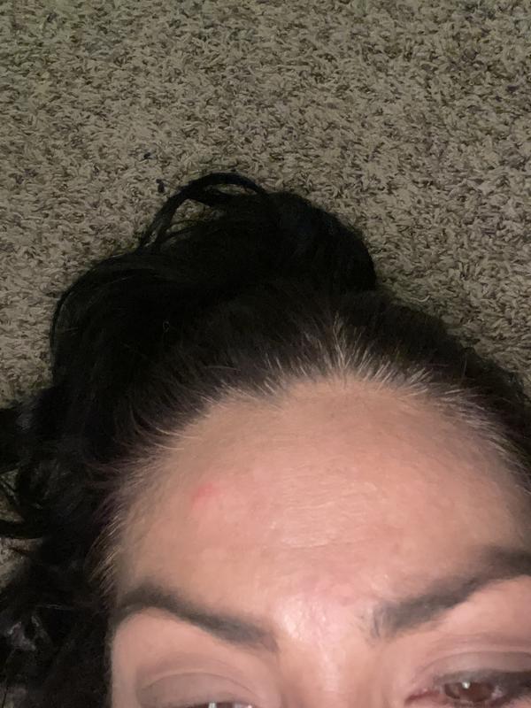 I’ve been broken out in various spots on my face since I started using this