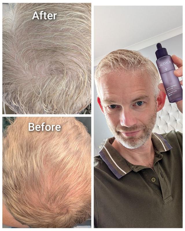 Amazing difference after just 10 days.