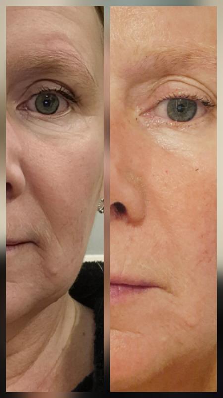 My skin loves it!