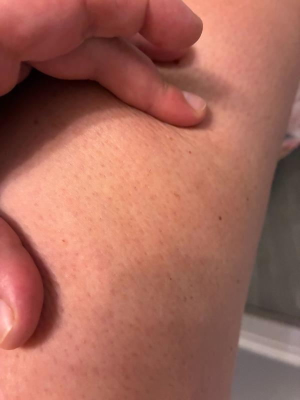 Great cellulite cream