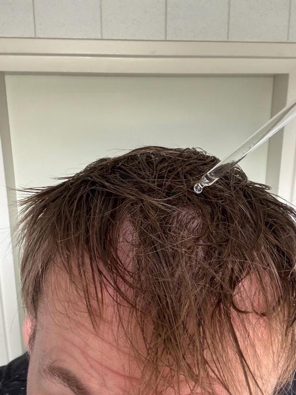 Makkelijk aan te brengen serum met zichtbaar resultaat