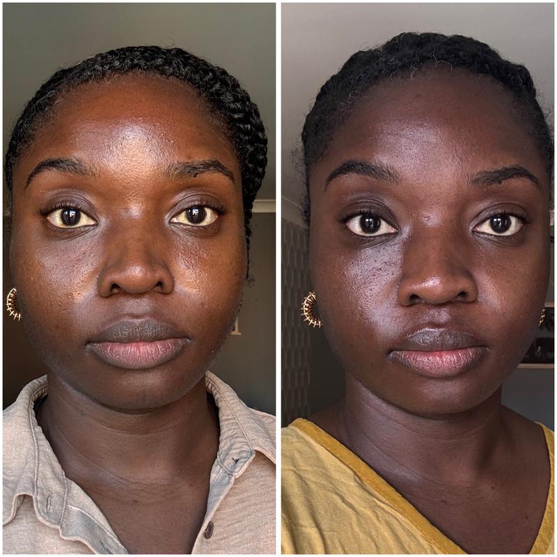 Reduced pores