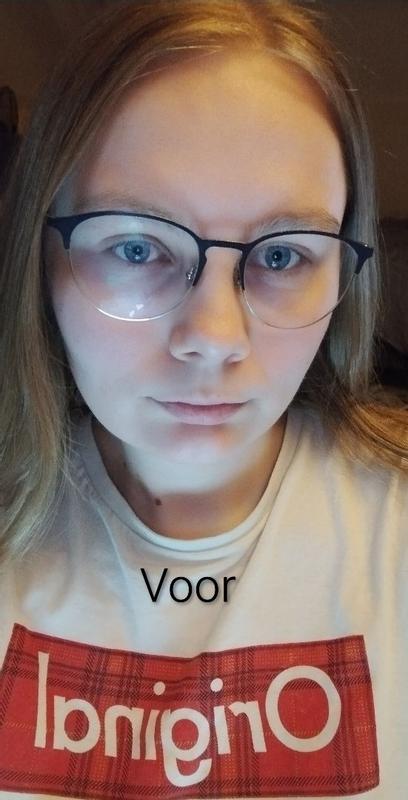 Helpt haaruitval verminderen.