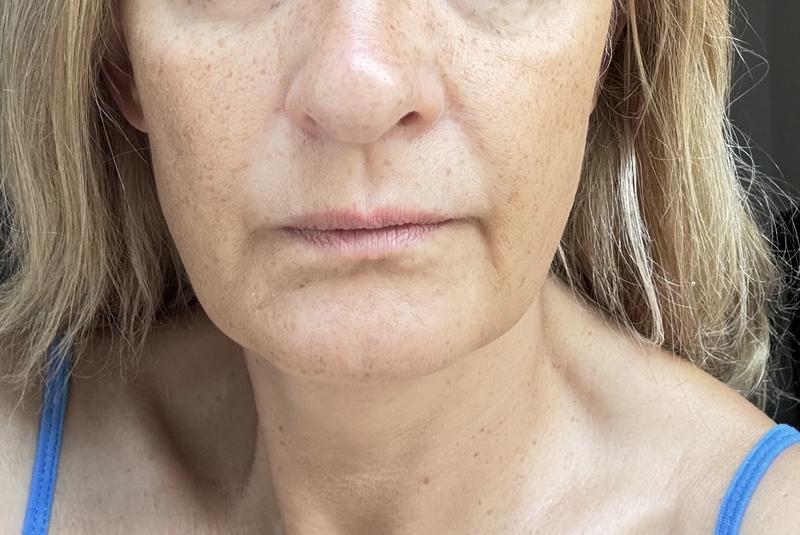 Love this serum
