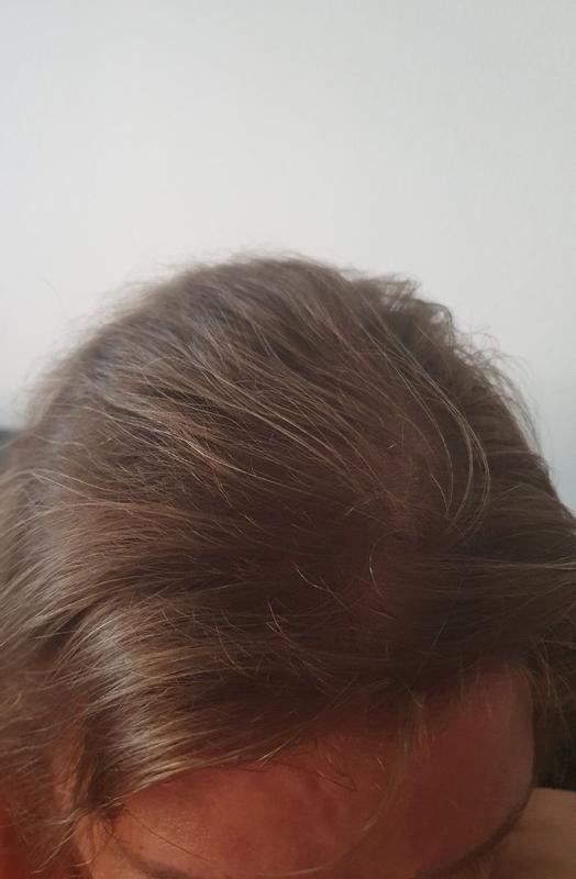 Ich bin zehr zufrieden mit dem Produkt und sehe bereits nach 2 Wochen eine deutliche Varänderung.