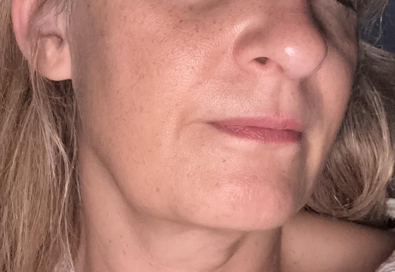 Love this serum