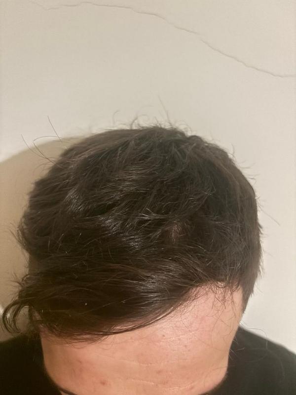 Um produto eficiente contra a queda de cabelo
