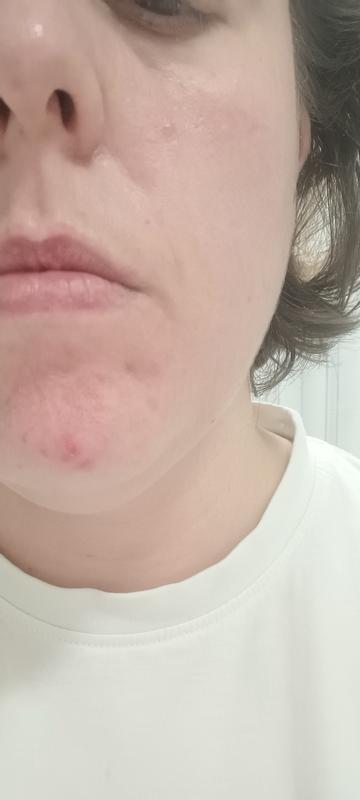 Textura boa mas agressivo para pele sensível