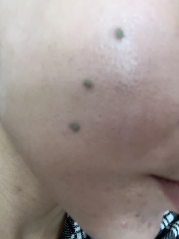 Mütiş spot krem