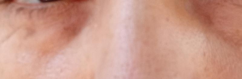 Allergic reaction probably