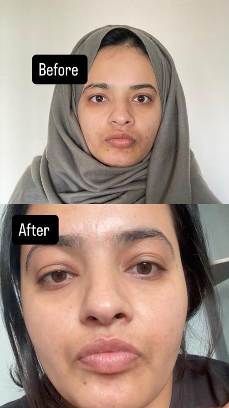 Ammmmmmazing face serum