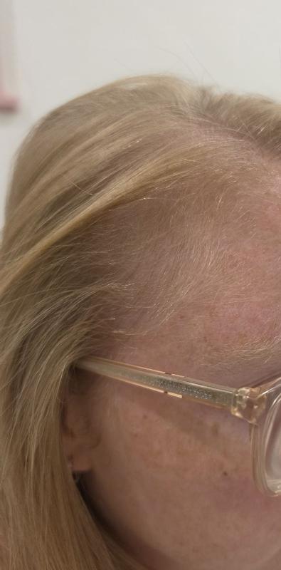 Helping with hair growth