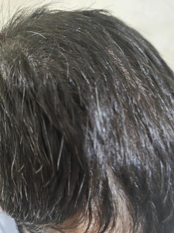 Dopo quasi un mese qualche baby hair si nota