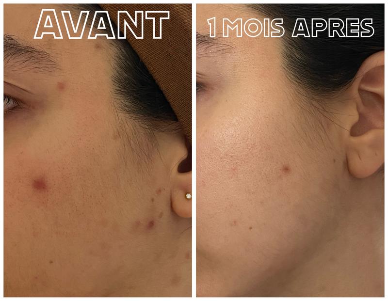 Gomme magique pour les taches