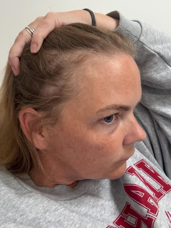 Beautiful hair loss serum