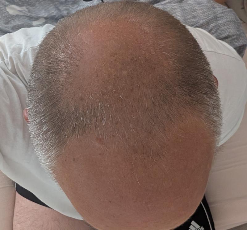 Sehr angenehmes Serum, welches mobilisiert