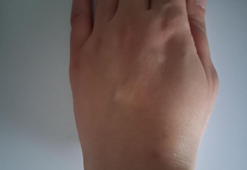 Mijn vaste zonnebescherming!