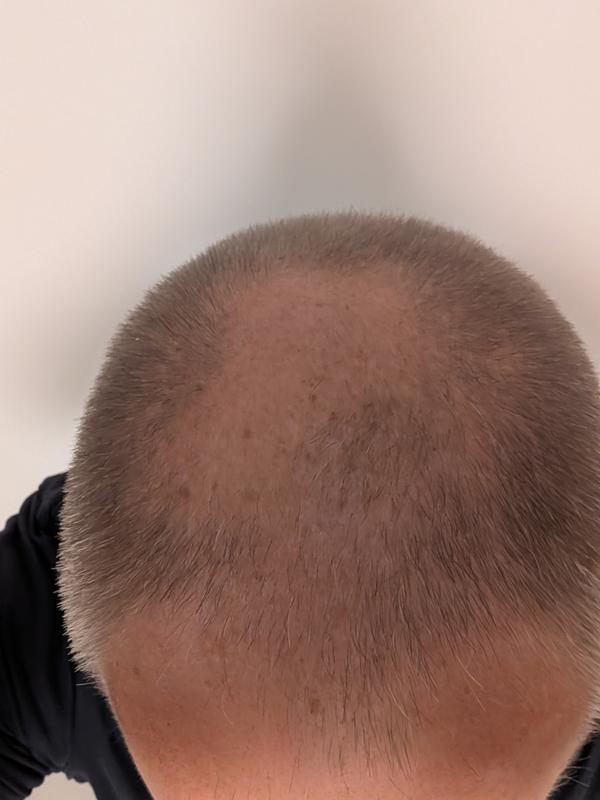 Sehr angenehmes Serum, welches mobilisiert