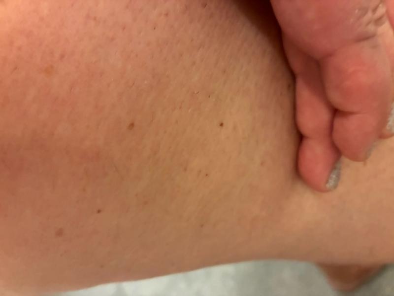 Great cellulite cream