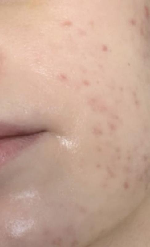 KESİNLİKLE ÖNERİYORUM