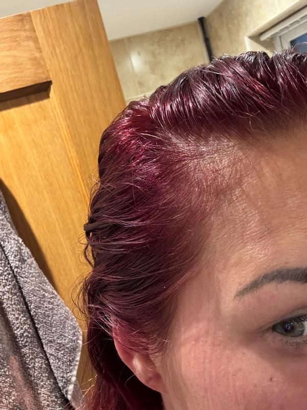 Very light serum that’s working for hair loss