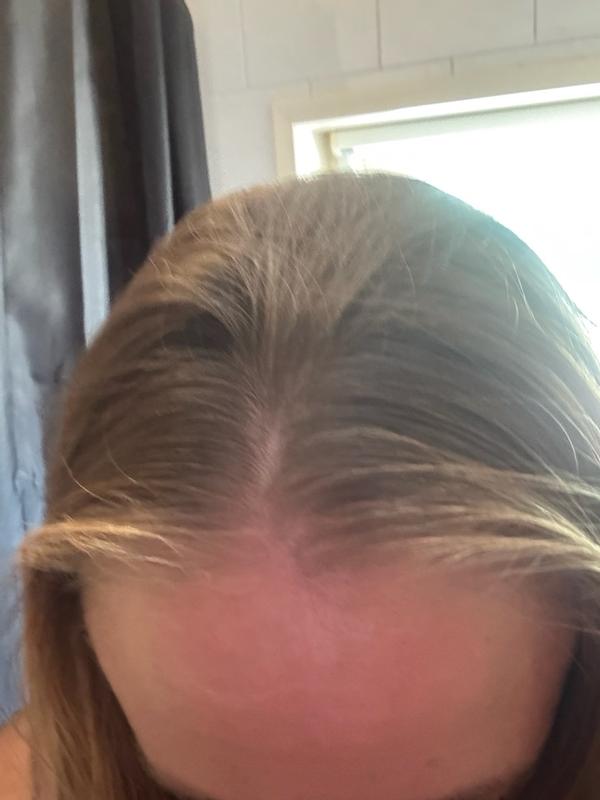 Haarserum