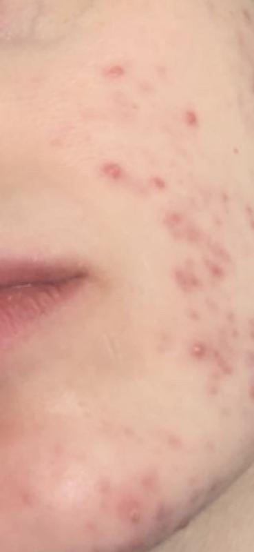 KESİNLİKLE ÖNERİYORUM