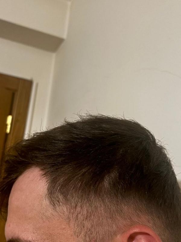 Um produto eficiente contra a queda de cabelo