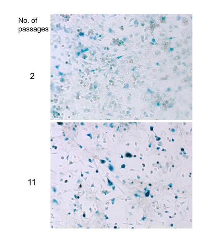 Senescence B Galactosidase Staining Kit Cell Signaling Technology