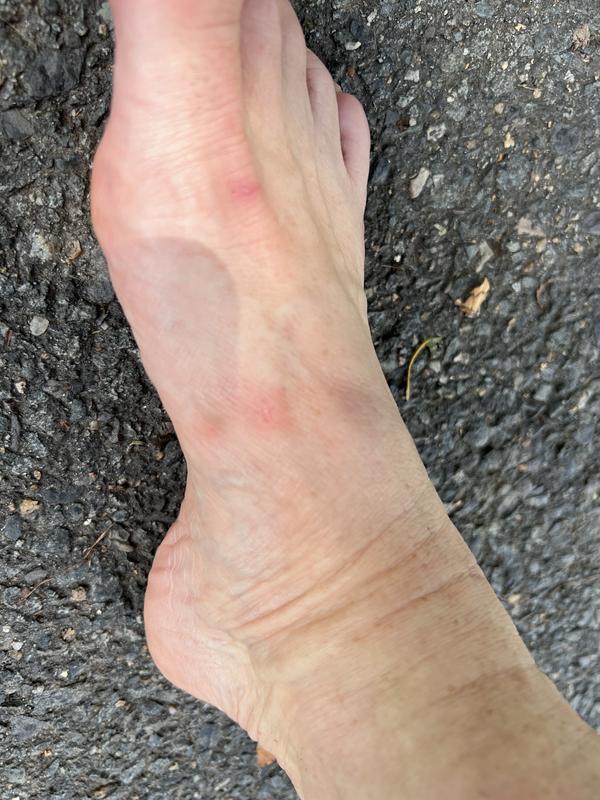 Photo submitted with review of product