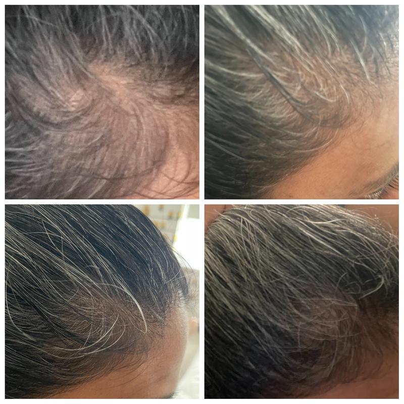 Rachelle testimonial