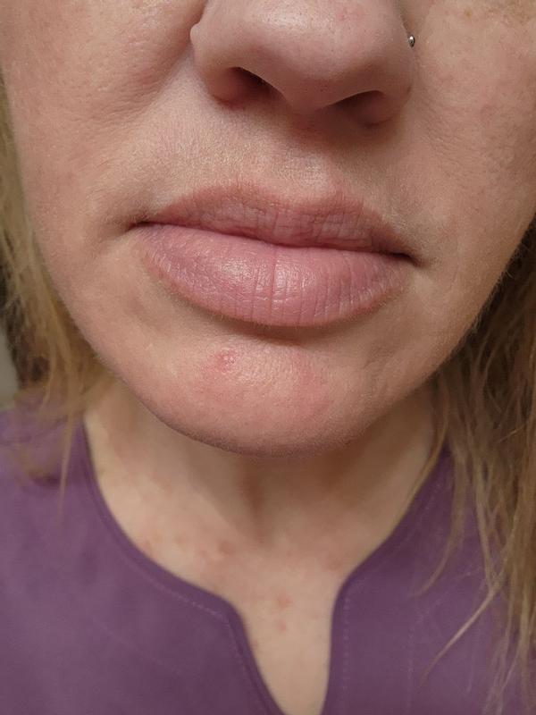 Review Thumbnail Image 1 180170044