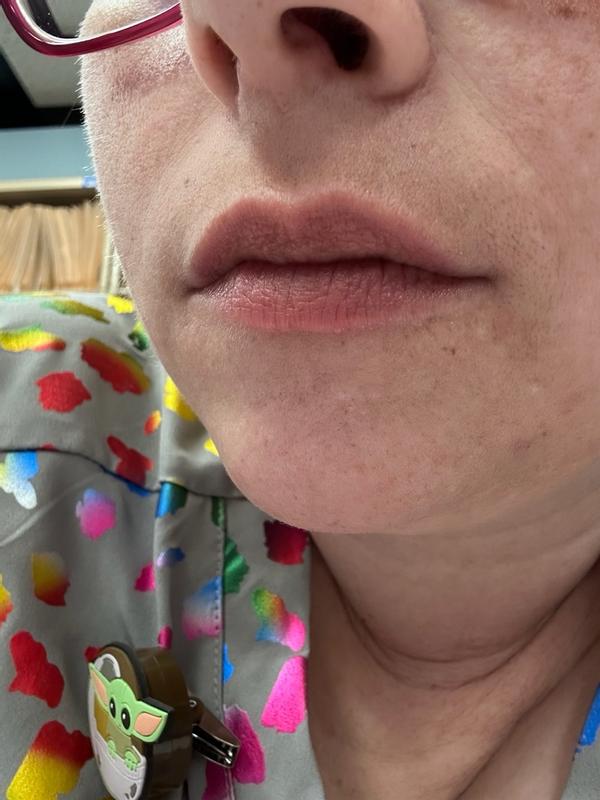 Review Thumbnail Image 2 180214561