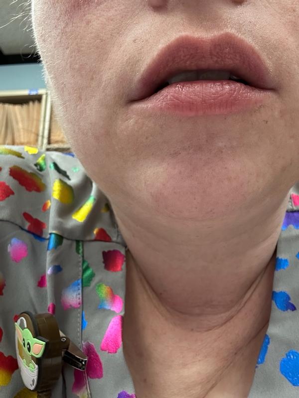 Review Thumbnail Image 1 180214561