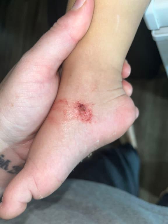 Photo submitted with review of product