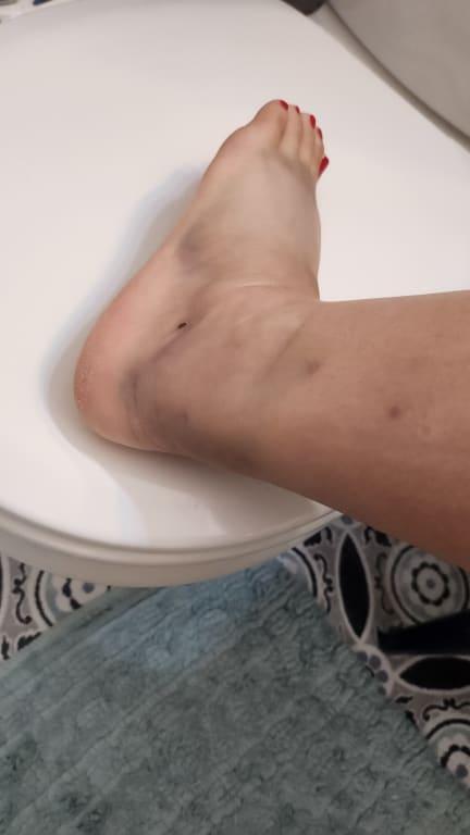 Photo submitted with review of product