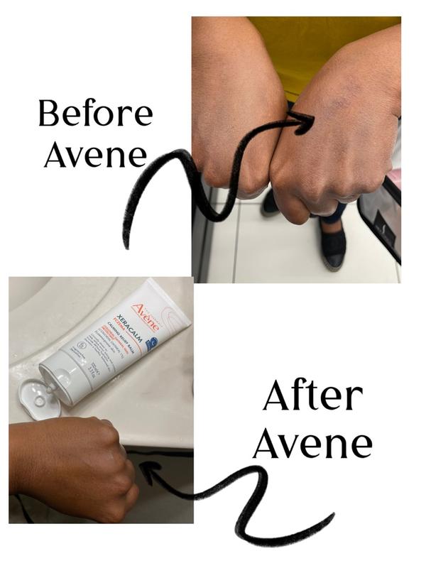 XeraCalm Eczema Calming Relief Balm | Avène USA