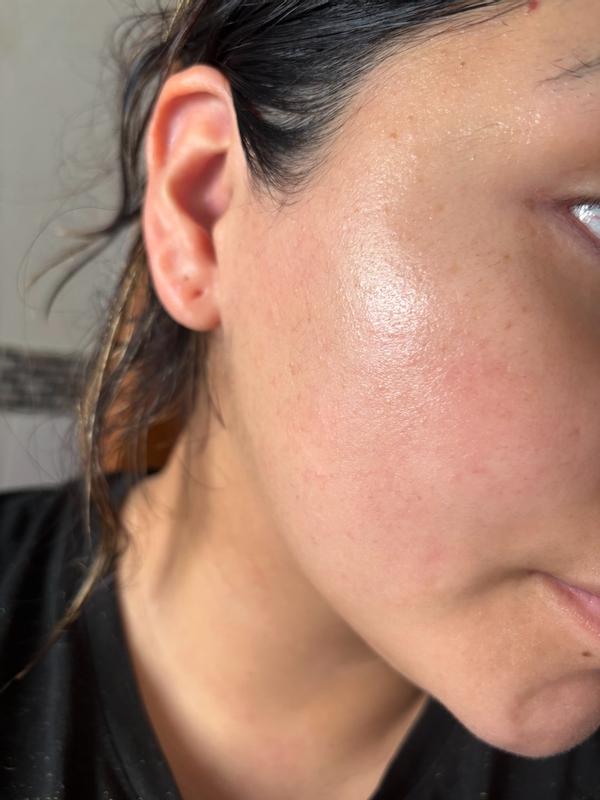 XeraCalm A.D Replenishing Milky Gel