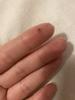 Pinched finger be careful so you don’t pinch babys finger