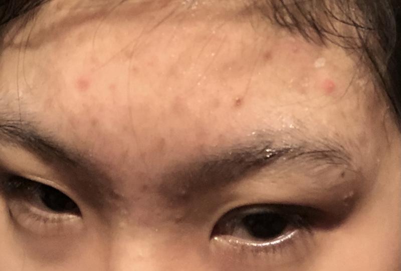 revolution dark spot