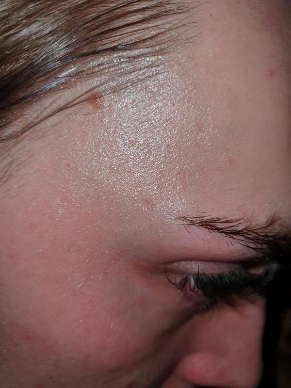 revolution combination skin peeling solution