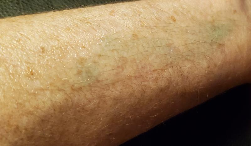 Photo submitted with review of product