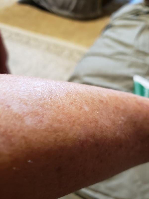 Photo submitted with review of product