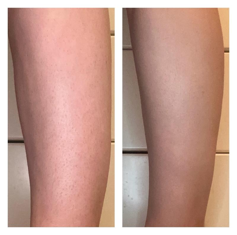 User generated review image 3