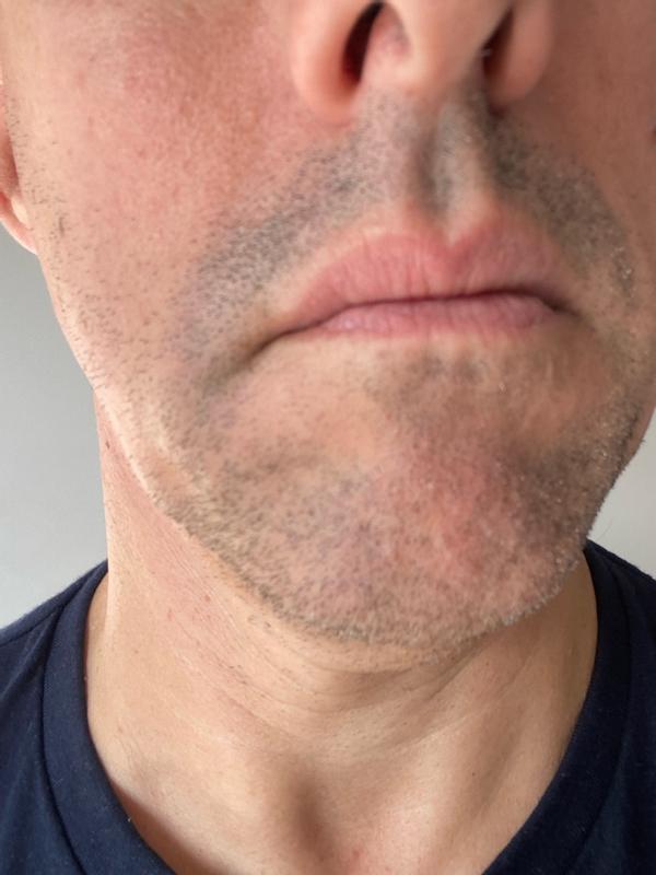 User generated review image 3