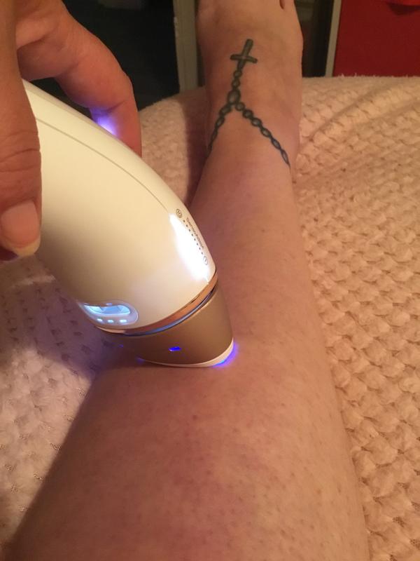 Braun Silk Expert Pro 5: Comparing 5 days of hair growth after treating  right leg for ~1mo : r/HairRemoval